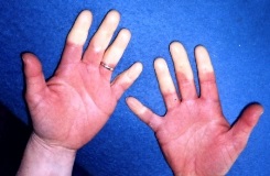 Hands with white fingertips on a blue background